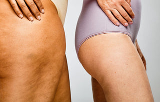 Come eliminare la cellulite dalle gambe in modo naturale